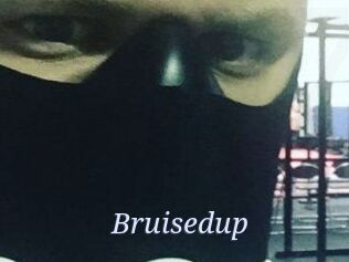 Bruisedup