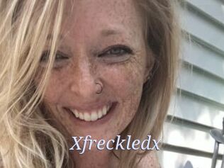 Xfreckledx